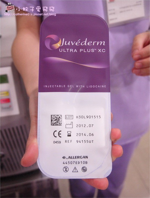 Juvederm ULTRA PLUS